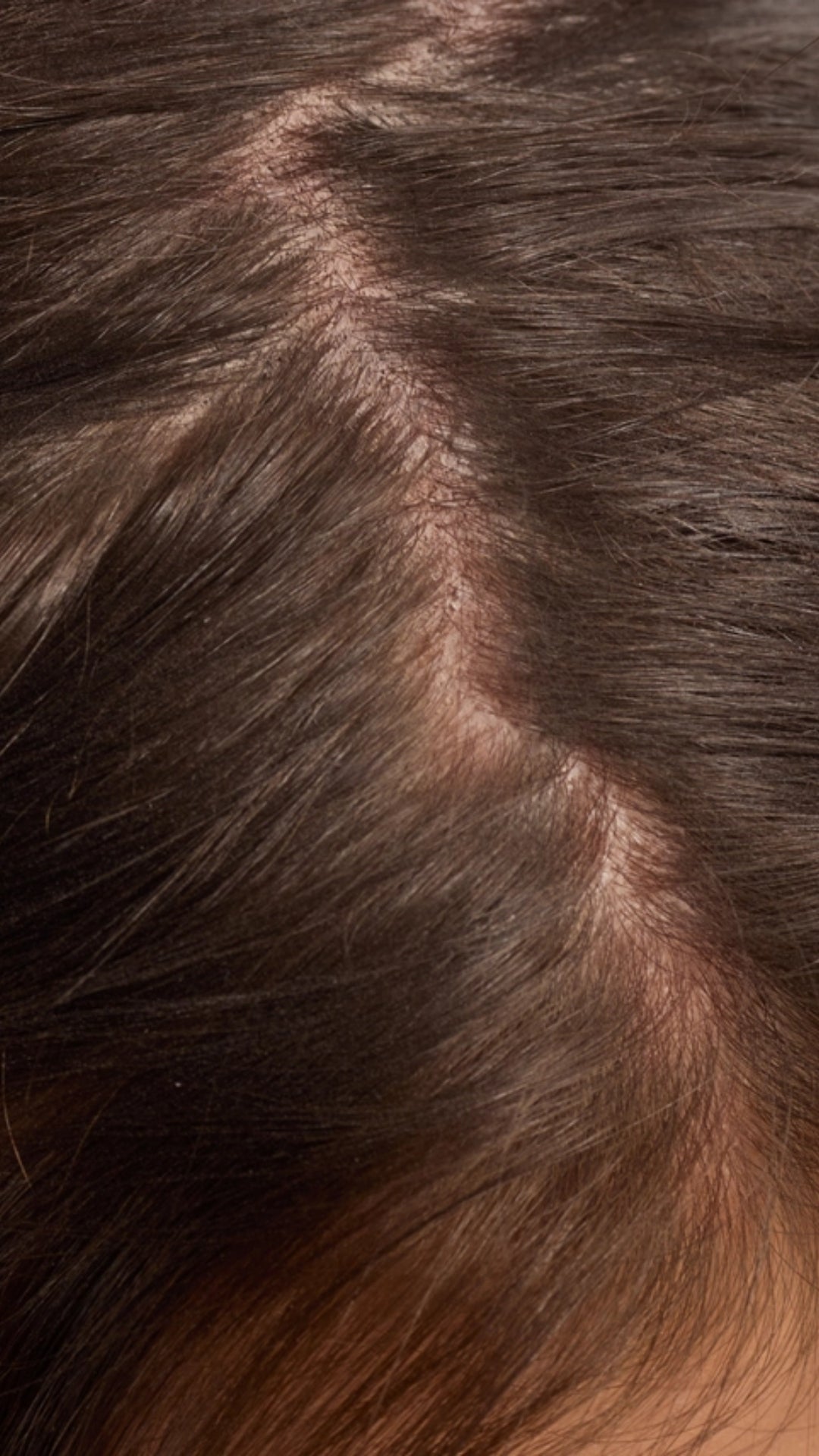 STRENGTHENING HAIR & SCALP OIL | KITSCH