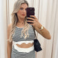 LISA TWO PIECE SHORT SET (STRIPE)